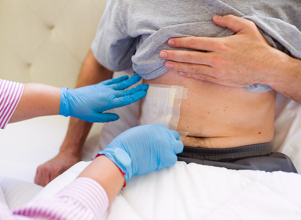 Wound Management Services at Home in Chicago | Private-Pay Wound Management Nursing in Chicagoland